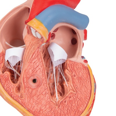 3B Scientific 2-Part Anatomical Heart Model with Left Ventricular Hypertrophy